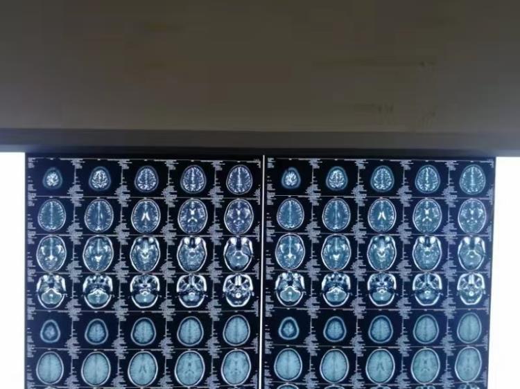 医用胶片供应商