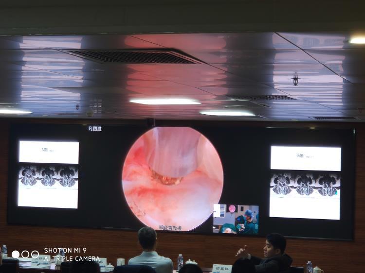 4K远程移动手术示教